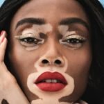 winnie harlow